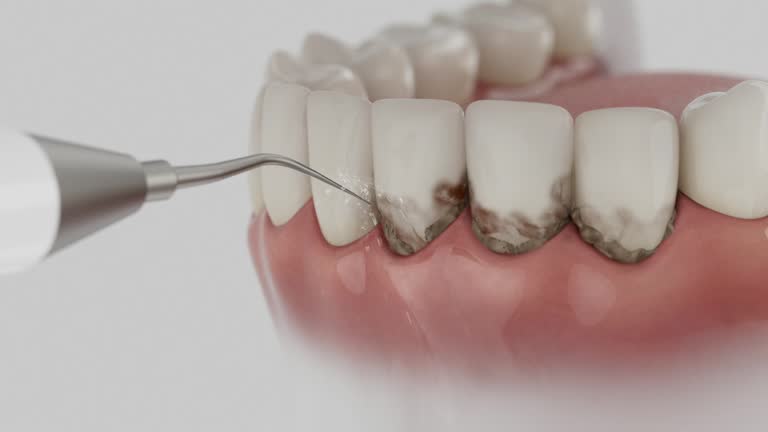Trusted Wisdom Tooth Removal service in Cherry Hill, VA - Dentist Open Now